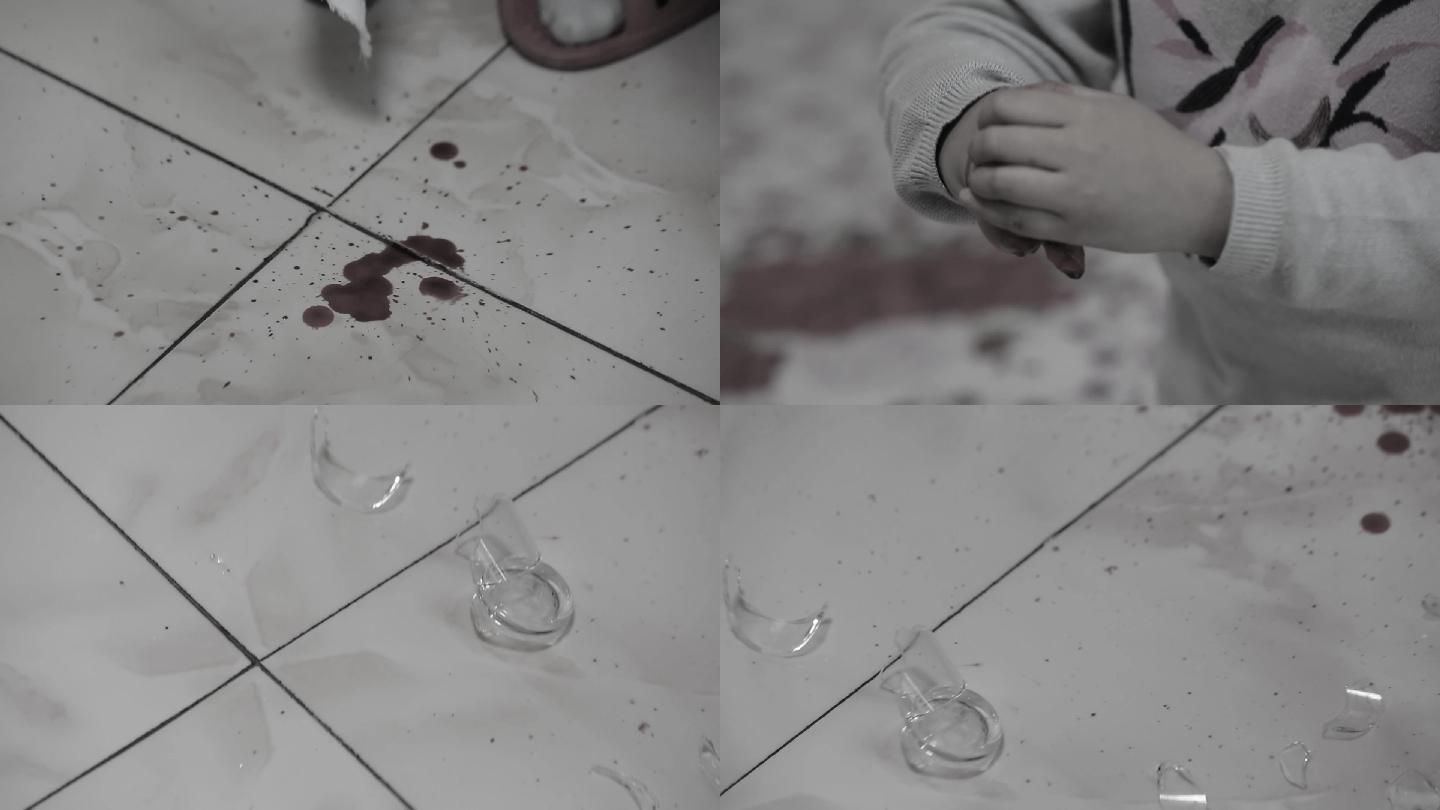 小孩 打碎杯子 手出血2