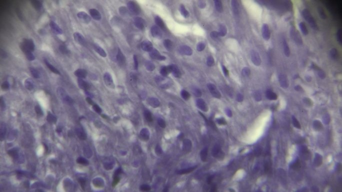 心肌细胞显微镜切片