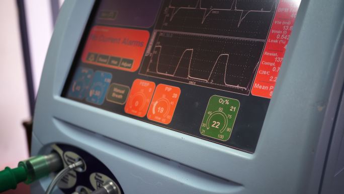 呼吸机显示屏医疗设备心电图体检中心