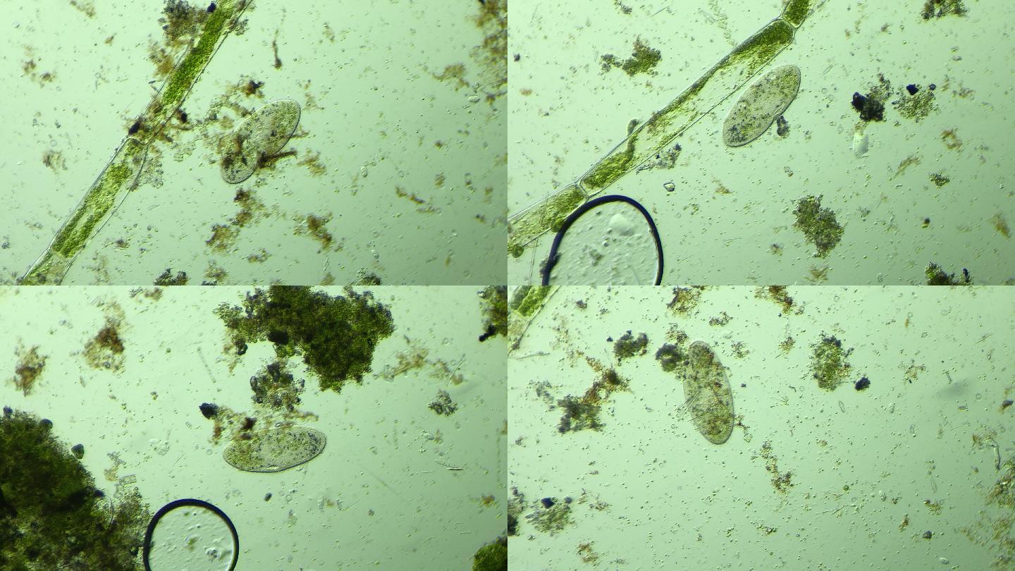 显微镜下的微观世界，草履虫7