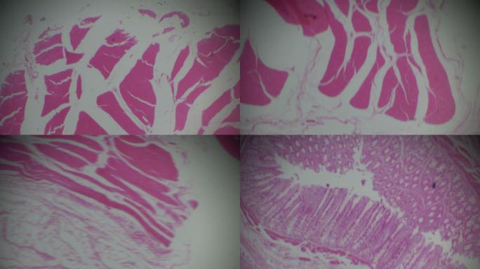 显微镜下的平滑肌横截面