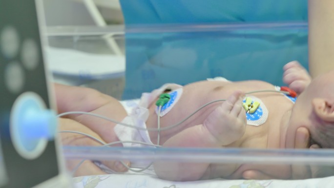 新生儿儿童出生婴儿医院ICU病房护理