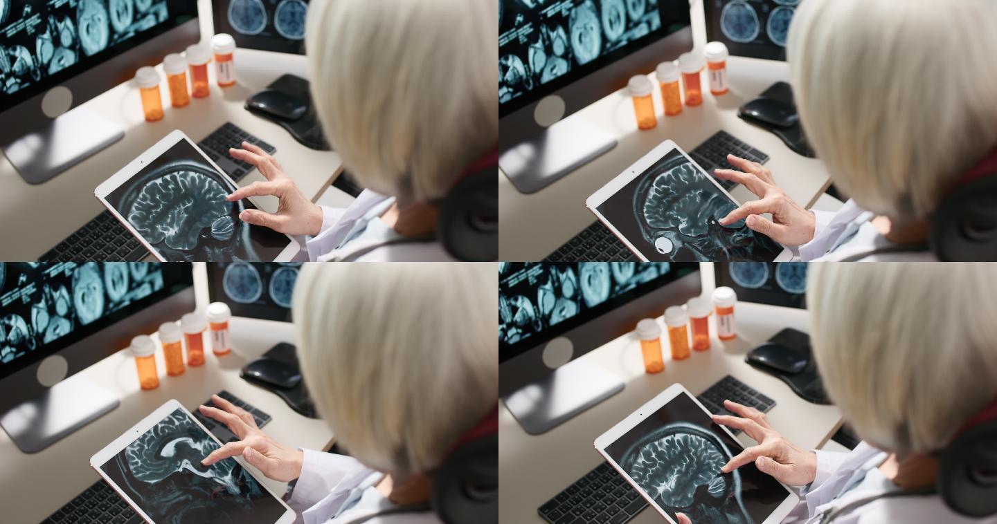 高级医生在数字平板电脑上进行MRI扫描分析