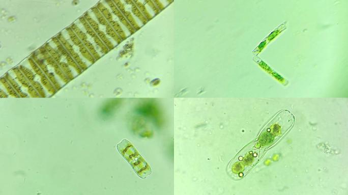 显微镜下的微生物硅藻合集
