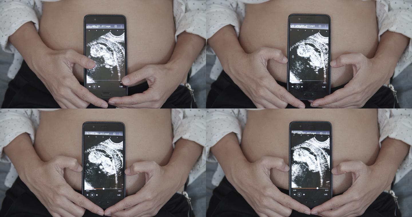 孕妇在智能手机上显示3D超声视频