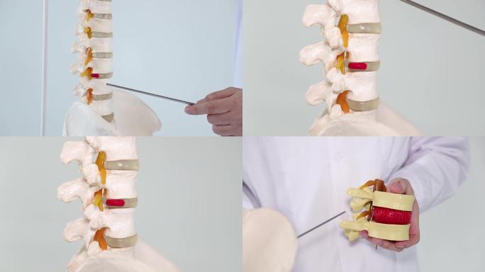 脊椎腰椎模型