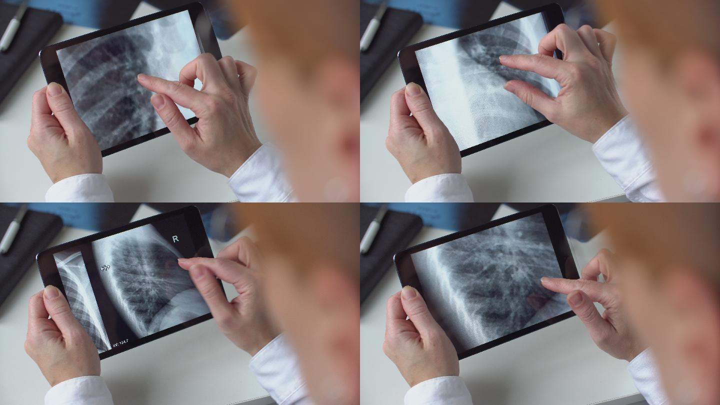 医生使用数字平板电脑