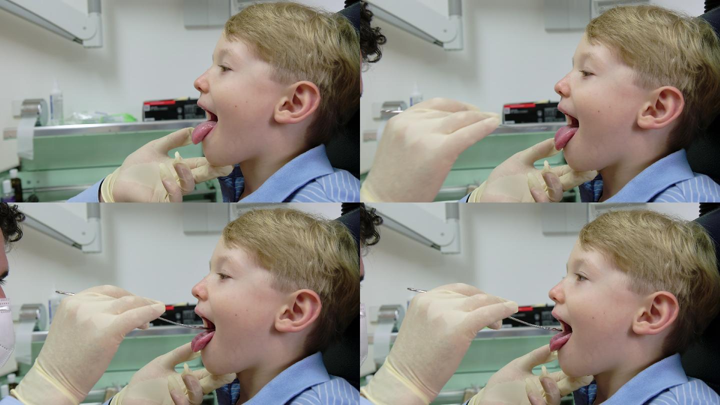 耳鼻喉科医生检查小男孩的喉咙