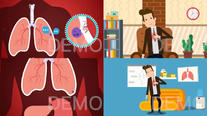 肺部疾病动画