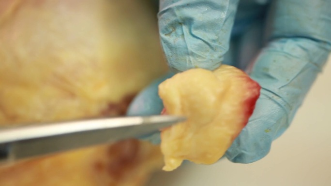 【镜头合集】解剖肉鸡尾脂腺淋巴系统细菌