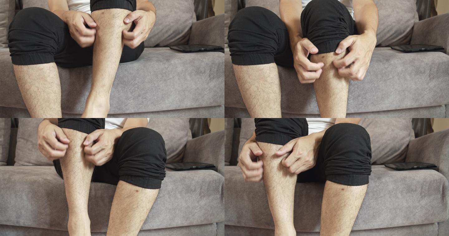 一名4k分辨率的亚洲男子坐在家里的沙发上，用手抓着他发痒的皮肤腿。虫咬痛的。医疗保健概念。