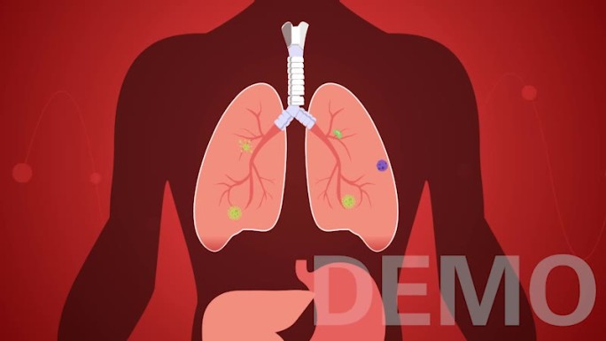 肺部疾病吃药治疗mg动画