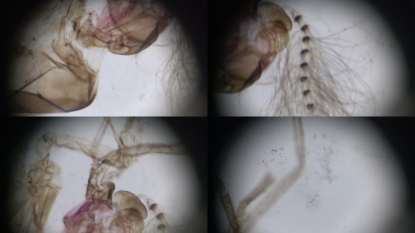 显微镜下的雄性蚊子