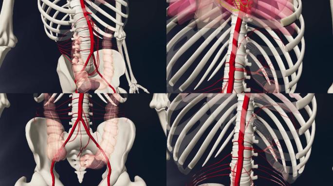 腹主动脉3D动画/人体三维动画