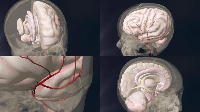大脑中动脉3D动画/人体三维动画