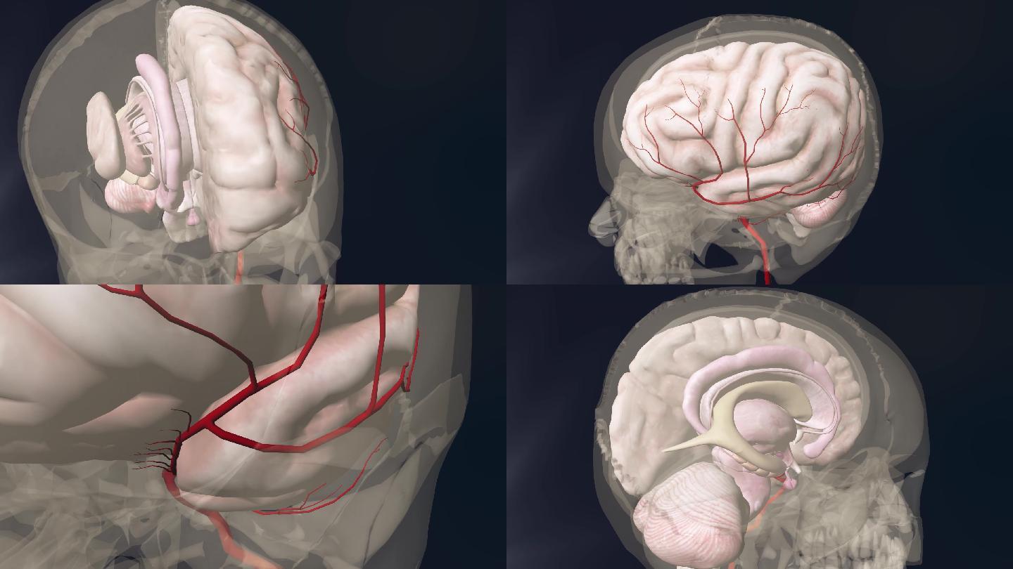 大脑中动脉3D动画/人体三维动画