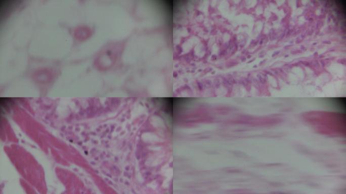 显微镜下的平滑肌横截面