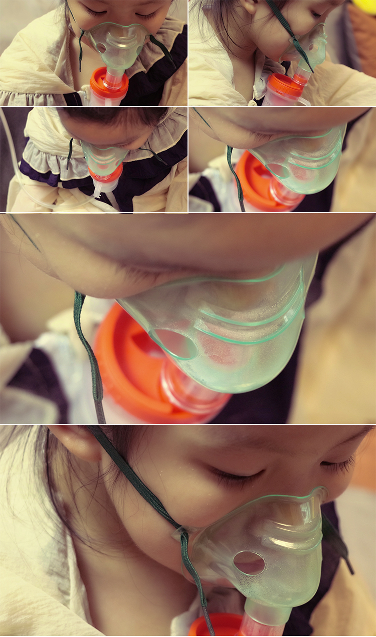 小孩儿童做雾化治疗儿童感冒支气管炎