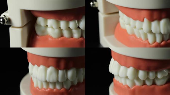 人的牙齿模型展示