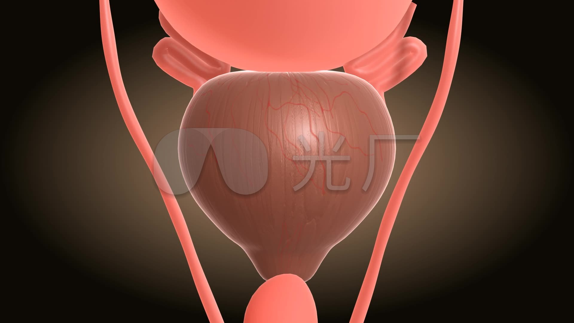 前列腺癌诊断金标准：超声引导下前列腺穿刺活检_直肠
