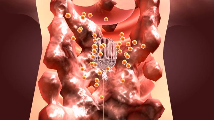 排出大量囊肿瘤体脓液黏液炎症全身气血循环