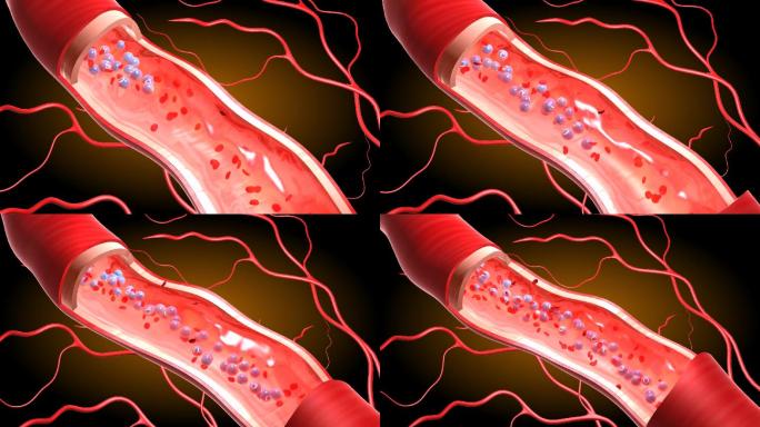 超氧分子导入血液提高患者血氧饱合度红细胞