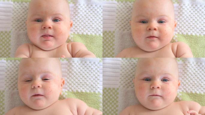 婴儿与过敏宝宝蓝眼睛外国婴儿外国宝宝