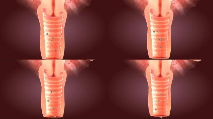 宫颈保护膜能防止炎症毒素的再次侵袭