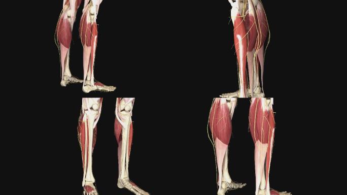 腿部抽筋3D动画/人体三维动画
