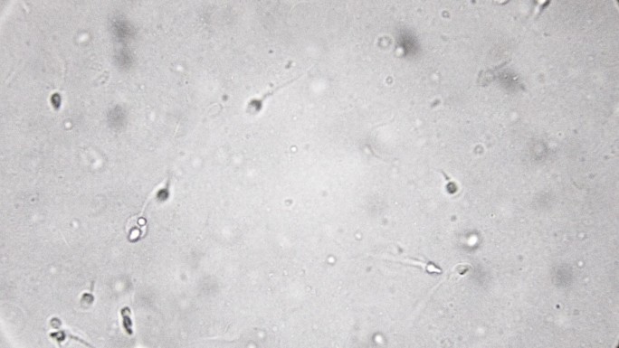 人类精子受精过程显微观察小蝌蚪