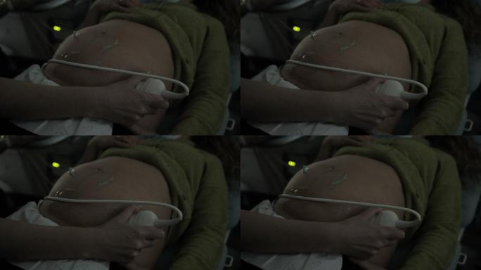 妇产科医生的手，在孕妇腹部装有超声波扫描传感器。