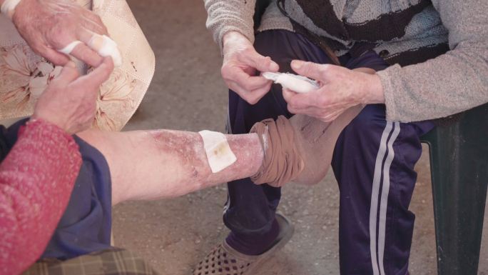 伸出援助之手。一位老太太腿上的开放性伤口用绷带包扎。医学概念。