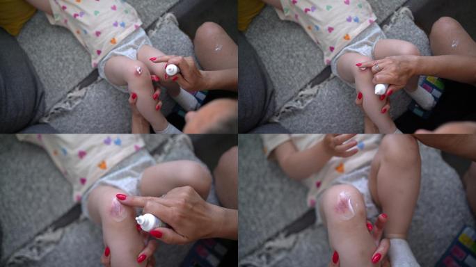 母亲把药膏涂在女儿擦伤的膝盖上，确保她很温柔