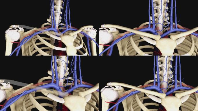 锁骨下静脉3D动画