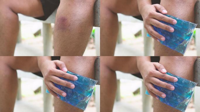 亚洲男子将冷凝胶敷在受伤的腿上
