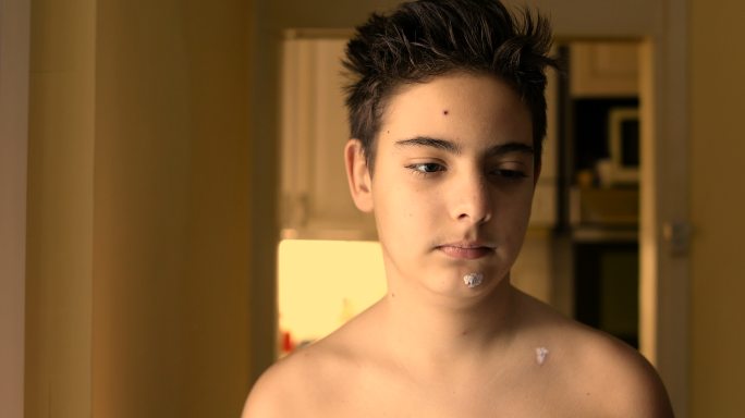 青少年麻疹医生用棉签给男孩治疗治疗荨麻疹