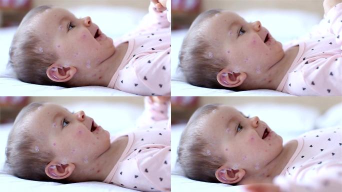 麻疹哭闹女婴为患者看病治疗诊断医学检查