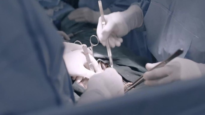 真实腹部外科手术场景 手术室开始到结束