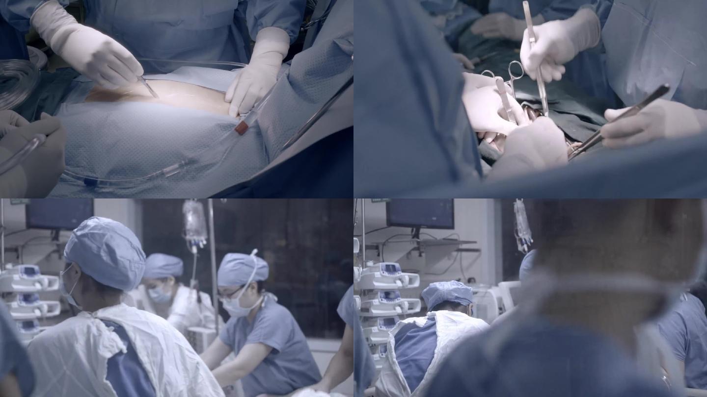 真实腹部外科手术场景 手术室开始到结束