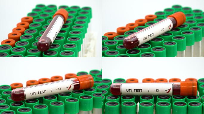 UTI试验用血液血液采样