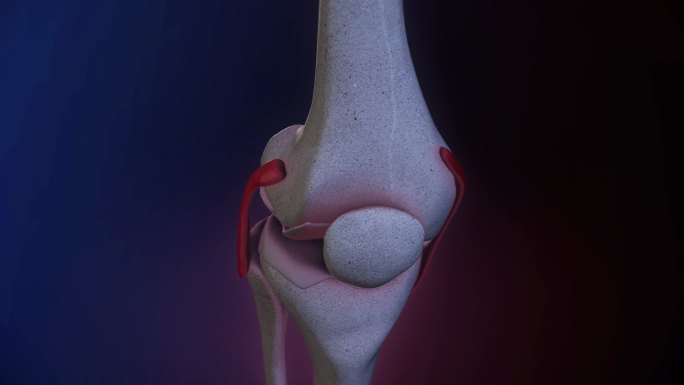 膝盖疼痛医学分医学知识医学动画演示