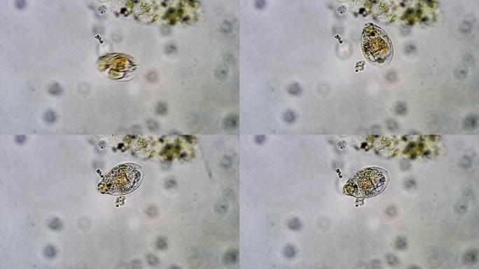 微生物-轮虫虫子寄生虫虫害