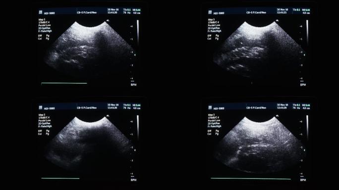 医用超声波病犬。4K