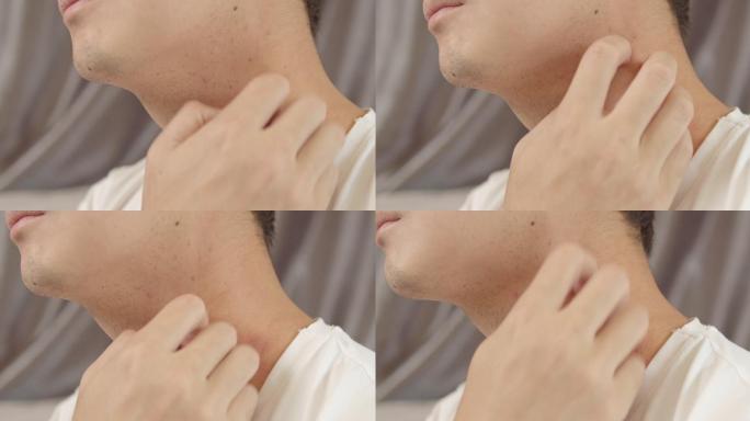 4k分辨率的亚洲男子用手挠痒痒的脖子。医疗保健和医疗概念。湿疹皮肤