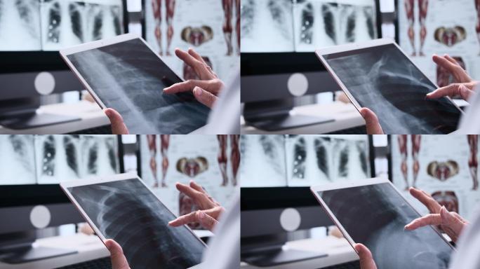 高级医生在肺部X光扫描上看数字平板电脑