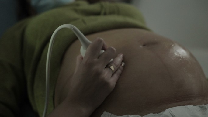 妇产科医生的手，在孕妇腹部装有超声波扫描传感器。