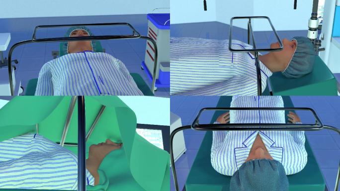 医疗器械模拟手术动画演示