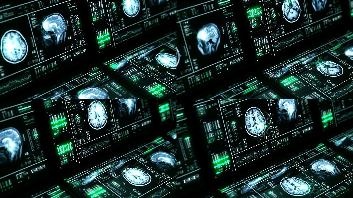 MRI脑扫描计算机