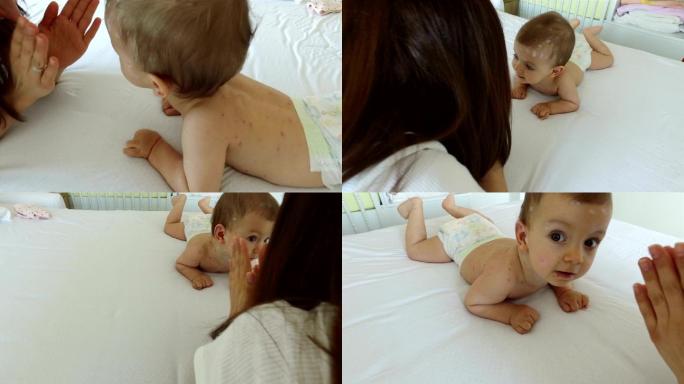 母亲照顾水痘婴儿最小病人