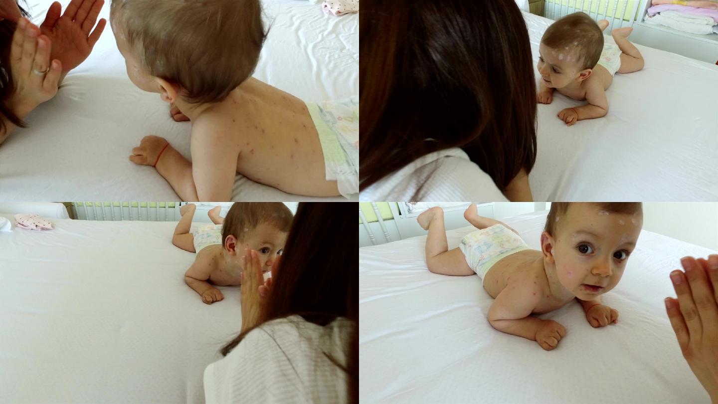 母亲照顾水痘婴儿最小病人